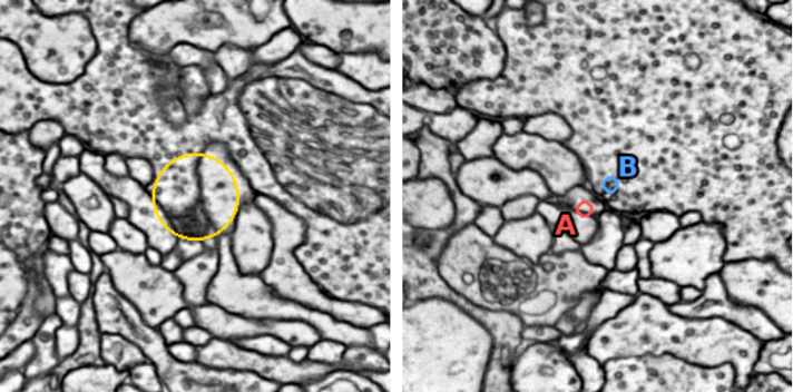 Benchmarking Vision-Language Models on Synapse Detection and Proofreading in Connectomics
