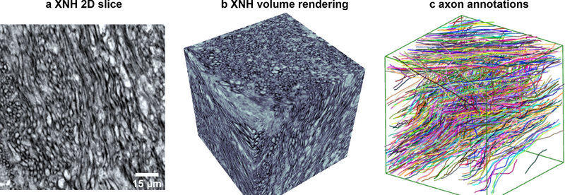 The XPRESS Challenge: Xray Projectomic Reconstruction – Extracting Segmentation with Skeletons